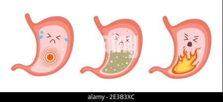 Caractères d'estomac malade. Douleurs à l'estomac, gastrite, indigestion, vomissements, problèmes de brûlures d'estomac. Illustration de Vecteur