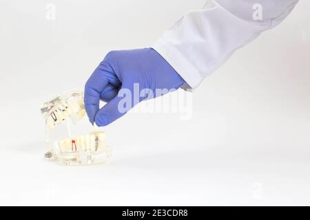 Médecin orthopédiste le dentiste installe un implant dentaire dans le modèle de la mâchoire dentaire sur un fond blanc. Concept pour l'installation des couronnes et des dents i Banque D'Images