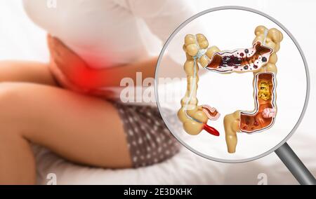 Douleur dans les intestins et l'abdomen. Dysbactériose, inflammation des intestins Banque D'Images