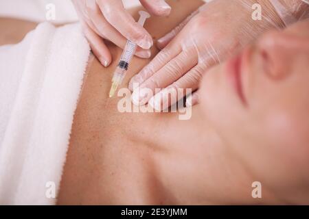 Gros plan d'un cosmétologue injectant du liquide de remplissage dans la peau du thorax d'une cliente femelle. Femme obtenant des injections rajeunissants de peau par cosmetolo Banque D'Images