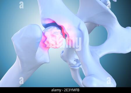 Arthrite canine et arthrose inflammation des articulations, détérioration des articulations chez les chiens, illustration 3d Banque D'Images