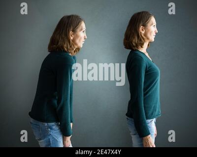 Avant et après l'entraînement de posture de douleur de dos de corps mince Banque D'Images