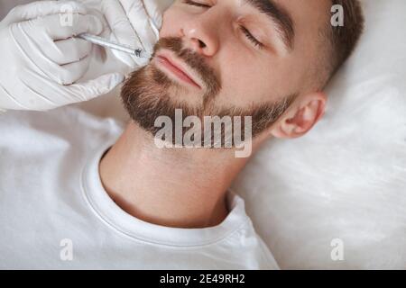 Un homme barbu est écourté pour le visage injections dans les zones froissées Banque D'Images