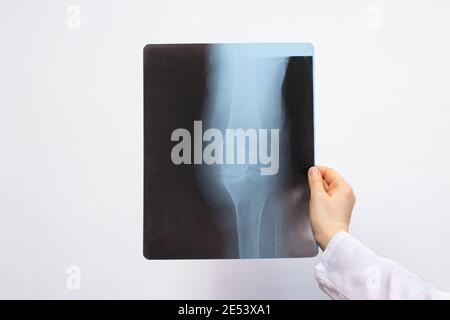 Le médecin examine une radiographie d'un patient présentant une lésion du genou sur un fond blanc avec un emplacement pour le texte. Banque D'Images