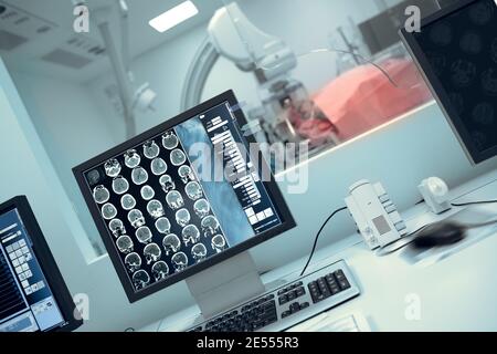 Acquisition Roentgen d'un patient présentant une pathologie neurologique. Banque D'Images