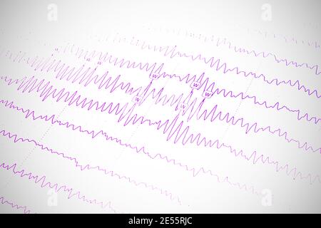 Les résultats de l'électroencéphalogramme sur papier, diagnostic de l'épilepsie Banque D'Images