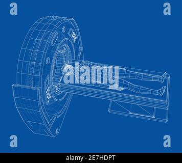 Appareil IRM pour l'examen du patient à l'intérieur. Vecteur Illustration de Vecteur