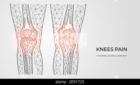 Illustration vectorielle polygonale de la douleur, de l'inflammation ou de la blessure dans les genoux. Anatomie des os des jambes humaines. Modèles de maladies orthopédiques médicales Illustration de Vecteur