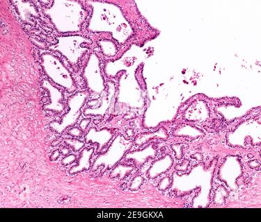 Paroi d'une vésicule séminale humaine. La muqueuse montre une surface très irrégulière avec beaucoup de plis qui ressemblent à des glandes. L'épithélium est une co pseudostratifiée Banque D'Images
