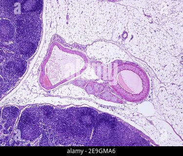 Faisceaux d'artère musculaire, de veines et de nerfs entourés de tissu adipeux, près d'un ganglion lymphatique. L'artère (droite) a une paroi plus épaisse et un diamètre plus petit Banque D'Images