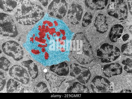 Microscope électronique à transmission de fausses couleurs (TEM) micrographe d'une cellule mitotique (bleue) entourée de cellules interphase. Les chromosomes (rouges) apparaissent a Banque D'Images