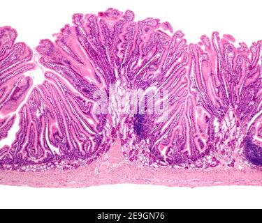 Première partie du duodénum montrant les glandes de Brunner situées sur la sous-muqueuse sur les plis circulaires ou les valves de Kerckring. Ici, l'aneth intestinal Banque D'Images