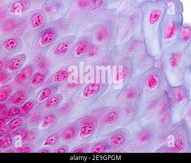 Micrographe à fort grossissement de l'épithélium stratifié squameux non kératinisé du oesophage montrant des desmosomes entre les cellules de la strate s. Banque D'Images