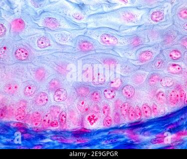 Épithélium stratifié squameux non kératinisé d'un oesophage montrant une mitose dans la couche basale ou strate basale. Pasini technique. Banque D'Images