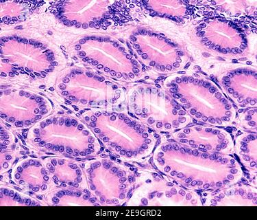 Coupe transversale de fosses gastriques bordées par l'épithélium de surface de l'estomac, formé par des cellules sécrétrices de mucus appelées cellules foveolaires Banque D'Images