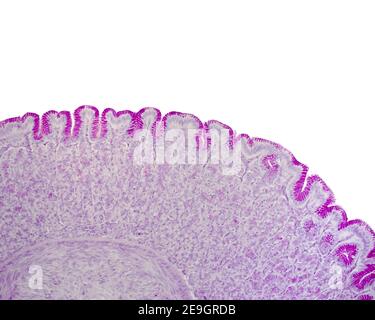 Muqueuse gastrique colorée avec la technique de l'acide périodique Schiff (pas) Montrant la positivité intense du pas de l'épithélium de surface et du fovéolaire cellules Banque D'Images