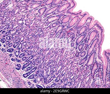 Muqueuse d'un estomac humain montrant : épithélium de surface, fosses gastriques. Les glandes fundiques s'ouvrent dans les fosses et ont des cellules pariétales et des cellules principales Banque D'Images