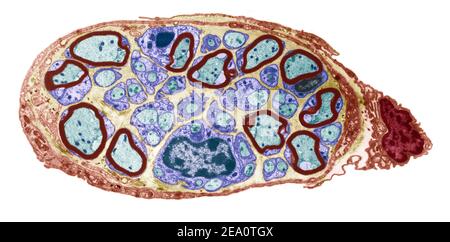 Nerf périphérique, TEM Banque D'Images