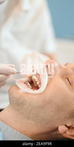 Dentiste et patient pendant un traitement orthodontique Banque D'Images