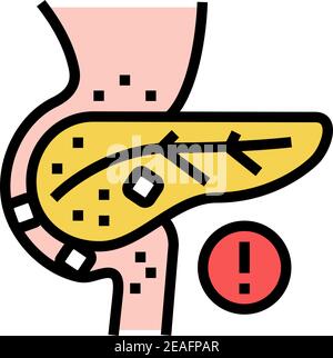 illustration vectorielle d'icône de couleur de pierres dans le pancréas Illustration de Vecteur