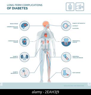 Infographie médicale sur les complications à long terme du diabète : effets du diabète sur le corps Illustration de Vecteur