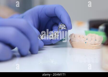 Bretelles orthodontiques. Alignement de la dentition ou de la morsure. Personne méconnaissable. Mains dans des gants de protection. Photo macro. Banque D'Images