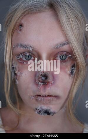 Maquillage sfx par gelures Banque D'Images