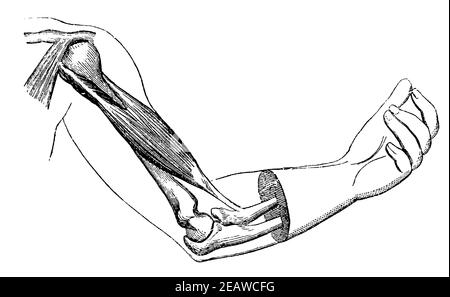 Les biceps se sont contractés à moitié. Illustration du 19e siècle. Allemagne. Arrière-plan blanc. Banque D'Images