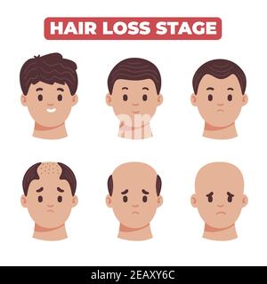 Flat-main dessiné cheveux perte étapes collection illustration vectorielle. Illustration de Vecteur