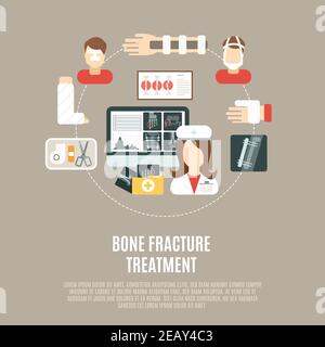 Concept de traitement des fractures osseuses avec des icônes de santé plates définir vecteur illustration Illustration de Vecteur