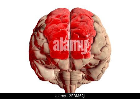 Cerveau avec gyrus frontal supérieur mis en évidence, illustration Banque D'Images