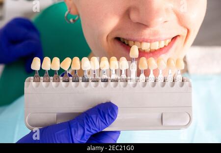 Jeune femme à la consultation du dentiste. Vérification et traitement dentaire dans une clinique dentaire. Hygiène et traitement buccaux. Banque D'Images