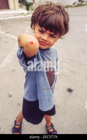 Un petit garçon appréhende et dans une certaine douleur montrant sa blessure après être tombé et paître son coude en vacances en Grèce. Banque D'Images