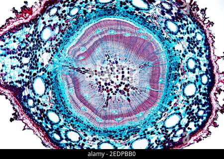 PIN (Pinus spec.), section transversale d'une tige de quelques années d'une section de pin, microtome Banque D'Images