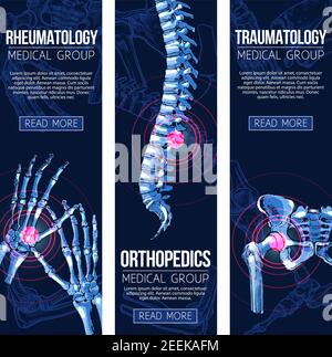 Bandeaux pour la médecine de traumatologie et d'orthopédie. Ensemble vectoriel de rayons X médicaux des os et des articulations du corps humain pour le genou ou le pied, la colonne vertébrale et Illustration de Vecteur