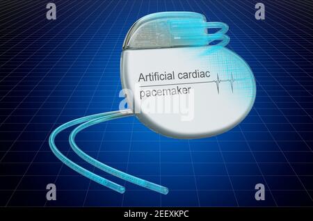 Visualisation modèle CAO 3d de stimulateur cardiaque artificiel, modèle. Rendu 3D Banque D'Images