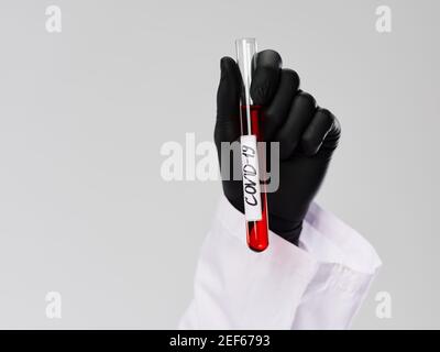 Test sanguin dans les mains d'un technicien de laboratoire noir diagnostic de recherche sur les gants Banque D'Images