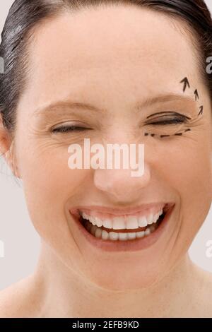 Gros plan d'une jeune femme avec des marques pré chirurgicales sur elle visage et sourire Banque D'Images