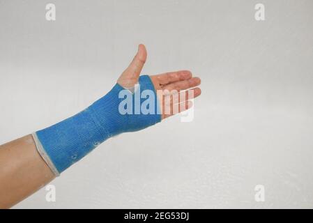 Enveloppé à la main dans un bandage imperméable moderne en fibre de verre Banque D'Images