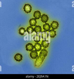 Particules du virus de la grippe H1N1 Banque D'Images