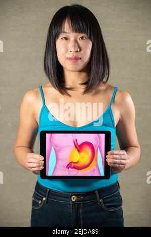Femme tenant écran avec dessin de l'estomac et de l'ulcère gastrique