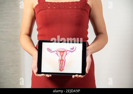 Femme tenant l'écran avec dessin des ovaires Banque D'Images