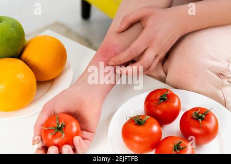 Vue rognée d'une femme présentant une réaction allergique tenant la tomate près de fruits frais Banque D'Images