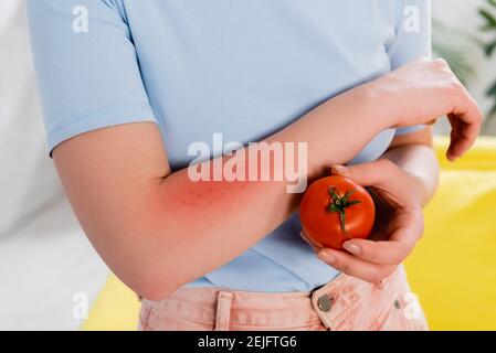 Vue rognée d'une femme présentant une allergie tenant la tomate Banque D'Images