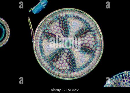 Diatomée (Diatomeae), diatomée de Dunkerque dans le Maryland, image microscopique de champ sombre, grossissement x140 lié à 35mm, USA, Maryland Banque D'Images