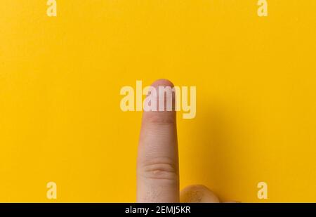 Gros plan Homme un doigt avec des ongles mordus, brandus, mâchés ou laids, un peu mauvais ongle et isolé sur un fond jaune Banque D'Images