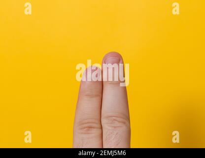 Gros plan deux doigts mâles avec des ongles mordus, brandus, mâchés ou laids, un peu mauvais ongle et isolés sur un fond jaune Banque D'Images