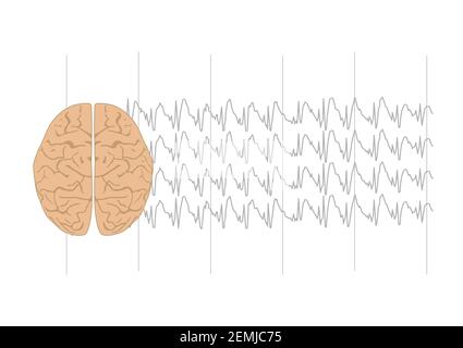 Illustration vectorielle du cerveau humain et des complexes anormaux de sphkie et d'onde généralisés représentant une crise généralisée. Illustration de Vecteur