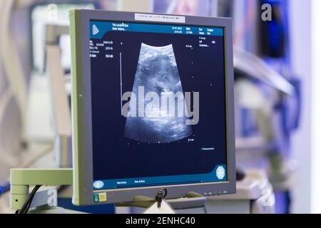 Les médecins et chirurgiens effectuent l'opération. Banque D'Images
