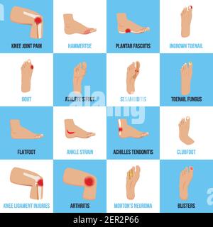 Ensemble d'icônes plates avec problèmes de pieds sur blanc bleu illustration vectorielle isolée en arrière-plan Illustration de Vecteur